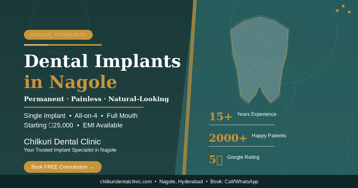 Dental Implants in Nagole, Hyderabad